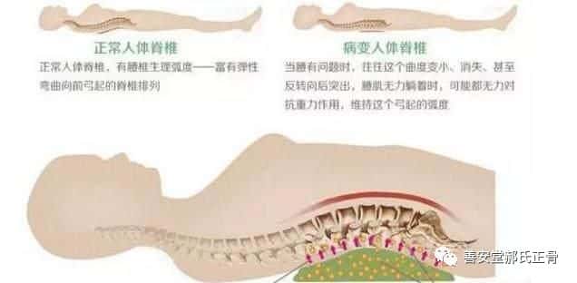 腰間盤突出墊小米袋好處多多  第1張